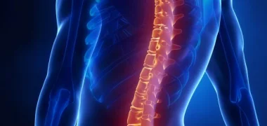 تقنية متطورة لعلاج تشوه العمود الفقري