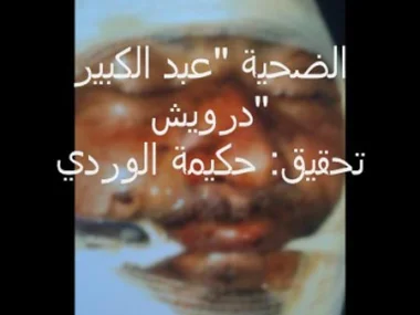 ‮ ‬انتحار‮ »‬كساب‮« ‬حرقا‮ ‬يثير العديد من التساؤلات