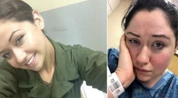 أمريكية تعاني من حساسية تجاه الجاذبية تجعلها غير قادرة على الوقوف على قدميها