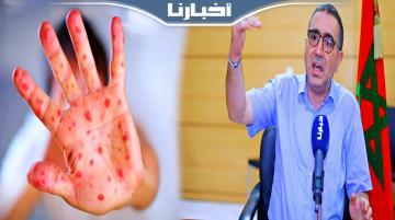مسؤول بوزارة الصحة: هناك سبب وحيد وراء عودة انتشار بوحمرون بالمغرب بعد سنوات من اختفائه