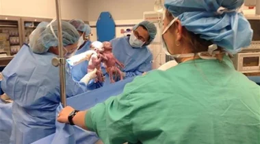 طفلتان توأم تخرجان من رحم والدتهما ماسكتا أيدي البعض
