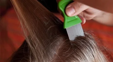 طرق و إجراءات منزلية لحكّة فروة الرأس