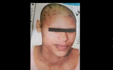 الحموشي يؤدب أمنيي مكناس بعد حادثة الاعتداء على شيماء