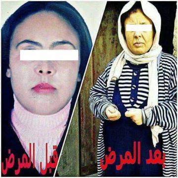 فيديو خطير: أشياء لا تصدق تم العثور عليها في صدر شابة مسحورة عند تنظيفها من طرف محسنين