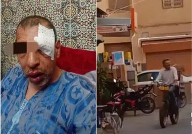دعوات حزبية لطرد فرنسي من المغرب بعد اعتدائه على شخص من ذوي الاحتياجات الخاصة
