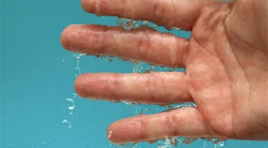 علاجات طبيعية لتعرّق اليدين المفرط