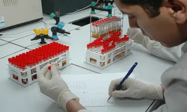 بشرى لمرضى "الايدز"...علماء ينجحون في السيطرة على الفيروس باعتماد علاج خلوي”