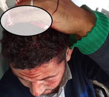 بالصور:اعتداء وحشي يطال سائق حافلة بالجديدة وهذا ما وقع
