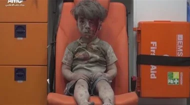 روسيا تنفي مسؤوليتها عن إصابة الطفل السوري عمران في قصفها لحلب