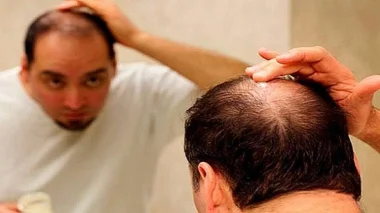 أسباب تؤدي إلى تساقط شعر الرأس!