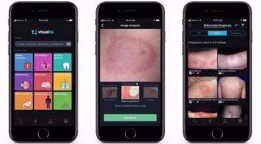 أبل أعطت تطبيقاً لأطباء بـ100 دولار في العام وهذه النتيجة
