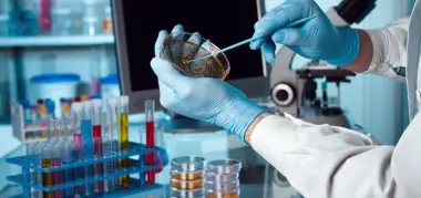 فيروس يطوي الجسد يثير القلق في بريطانيا.. قفزة حادة في إصابات “تشيكونغونيا”