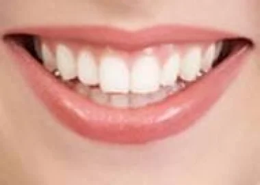 هل هناك علاقة بين أنواع الغذاء وأمراض الفم والأسنان؟
