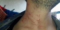 هادشي بزاف .. 7 أشخاص يعتدون على أستاذ بتازة (صور)
