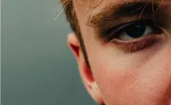 7 أطعمة ومشروبات تُسرّع شيخوخة البشرة وتفقدها نضارتها