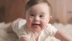 خطوة علمية جريئة.. حذف كروموسوم إضافي يفتح آفاقاً جديدة لأبحاث متلازمة داون