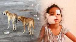 فاس.. كلب مسعور يمزق وجه طفلة صغيرة ويتركها بـ30 غرزة والأم تروي لحظات الرعب