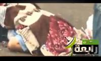 قنص أحد المتظاهرين في الرأس وخروج المخ في رابعة (+18)
