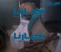 وفاة سجين بمستشفى "محمد الخامس" بآسفي وهذه هي الأسباب