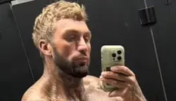 تعاطي المنشطات يدفع لاعب كمال أجسام إلى حافة الموت