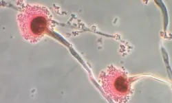 تحذير من انتشارها السريع.. فطريات قاتلة تأكل لحمك من الداخل