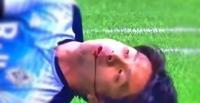 بالفيديو.. لحظة تعرض لاعب بالدوري الكندي لإصابة مميتة