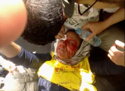 عاجل : جرحى واعتقالات بالعشرات في تدخل أمني بحق معطلي المحضر