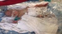 طفل ولد بحجم حقنة يتحدى توقعات الأطباء
