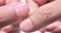 ما هي دلالات الخطوط  الرأسية والأفقية للأظافر؟