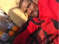 فيديو صادم لمتشرد ينخر الدود لحمه في حي السلام قرب عمالة سلا