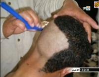 انتحار شاب سيدي بطاش الذي قصِّ قائد شعره