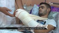 أول عملية جراحية لإعادة يد مبتورة بالفقيه بنصالح