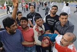 عشرات القتلى والجرحى إثر انفجارين بمستودع للذخيرة قرب بنغازي 