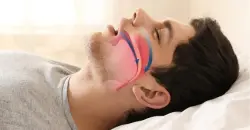 خطير..ما يفعله الشخير بالدماغ والذاكرة