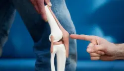 نساء يلجأن إلى جراحة تقصير الساقين بحثاً عن شريك