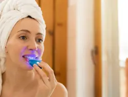 تبييض الأسنان.. تحذير من منتجات "خطيرة" تباع عبر الإنترنت