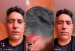 فنان راب شهير يفاجئ جمهوره بسرد وقائع تعرضه لاعتداء دموي