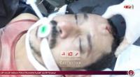 مشاهد صادمة من مجزرة رابعة العدوية +18