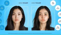 دراسة تكشف تأثيرات الحرمان من النوم على البشرة والوزن