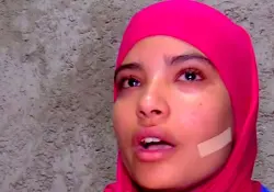 على هامش قضية "سلمى" وما أثارته من جدل: حقوقيون يطالبون بمراجعة جنائية لإقرار معايير التشويه الجمالي ضمن القانون