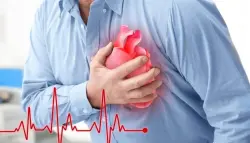 دهون العضلات قد تفسر ضعف مرضى الشرايين الطرفية حتى بعد فتح الشرايين