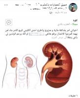 صادم : مغربي يطرح " كليته " للبيع عبر الفيسبوك وهذه شروطه  ( الصورة )