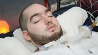 بالفيديو.. "الأمير النائم" يحرك يده بعد 15 سنة من الغيبوبة