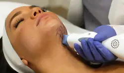 طرق فعالة لمحاربة تجاعيد الرقبة دون جراحة