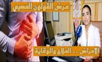 مرض القولون العصبي : أعراضه البارزة، كيفية علاجه وطرق الوقاية منه