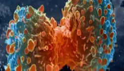 علاج جديد يعيد الأمل لمرضى سرطان البنكرياس: الأجسام المضادة تكشف "التمويه السكري"