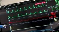 طلاب تمريض ينقذون مدربهم باستخدام تقنيات تعلموها منه