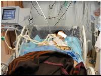 وفاة ثلاثة أطفال جراء عطب بنظام توزيع الأكسجين داخل قسم العناية المركزة بمستشفى الاطفال بالرباط 