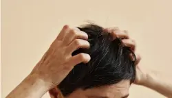 حكة الجلد وفروة الرأس: عرض بسيط أم مؤشر على مشكلة صحية خطيرة؟