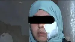 الحكم الصادر في حق معتدية شوهت وجه فتاة بدافع الحقد والغيرة ببركان